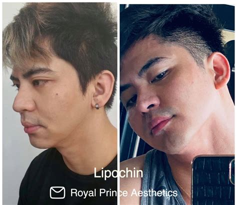 Dermatology doctors in Batangas City, Batangas .